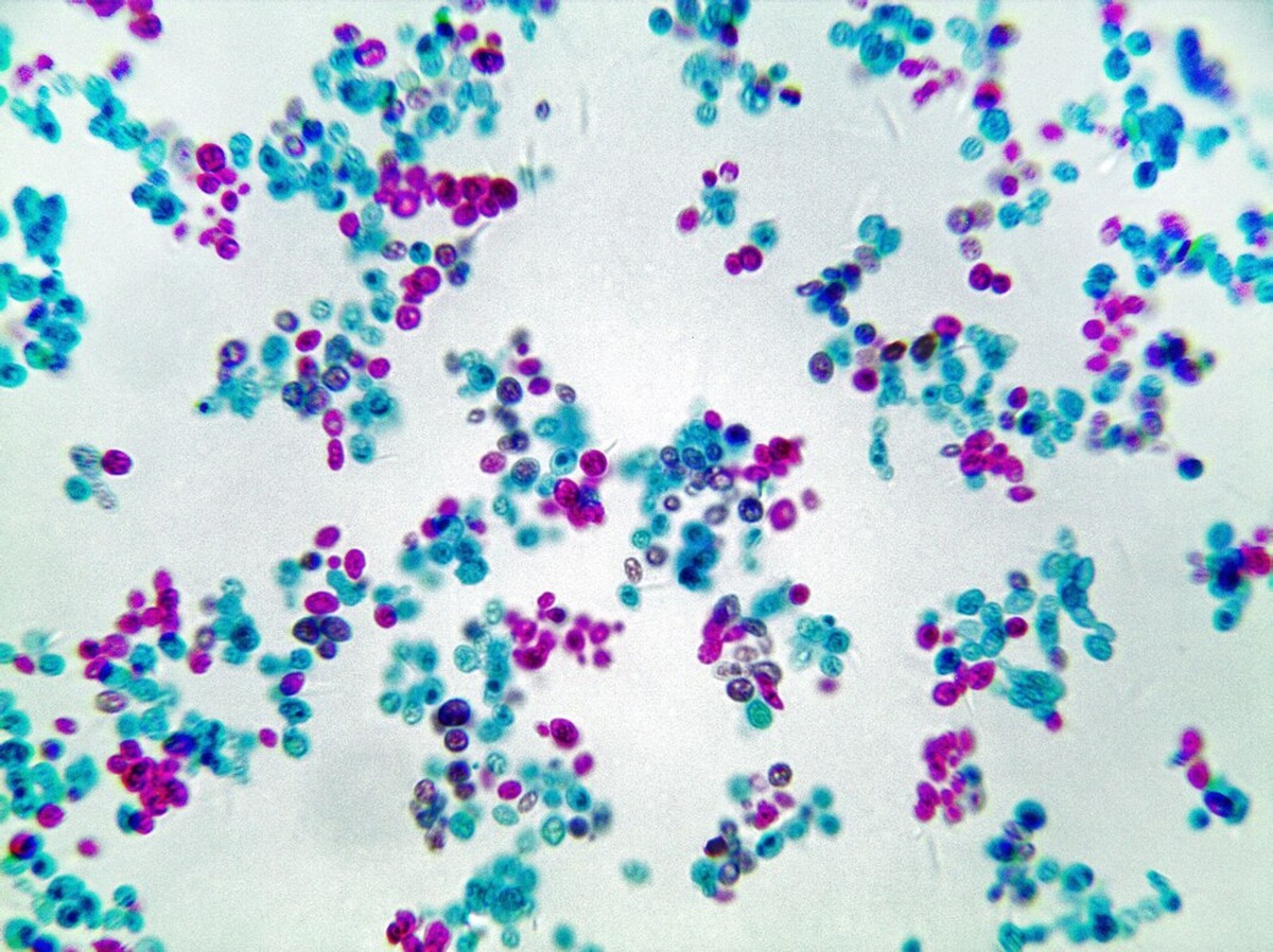 В Кении описали Candida auris, устойчивую к четырём классам препаратов